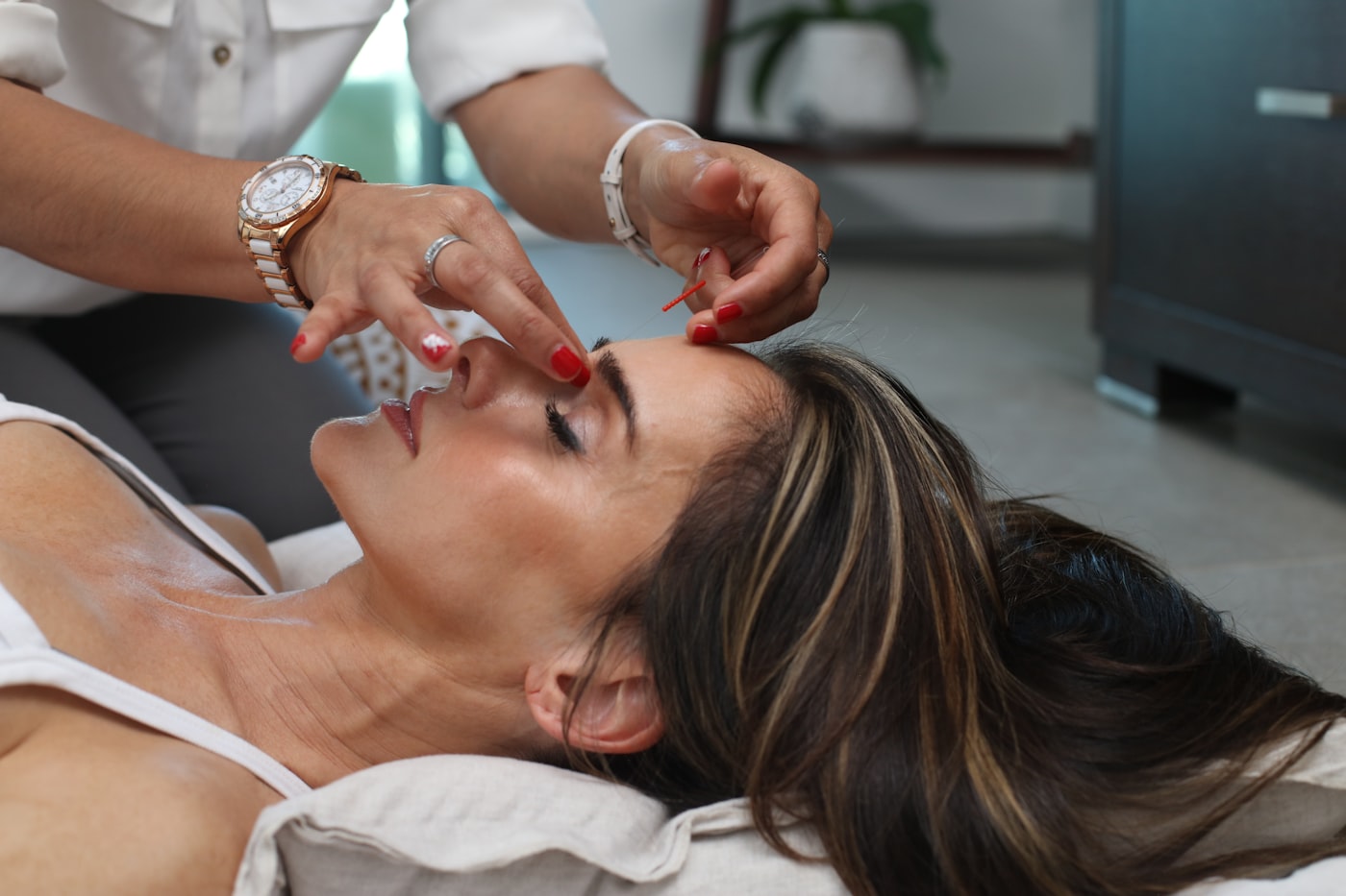 Acupuncturist placing a needle during a facial acupuncture session